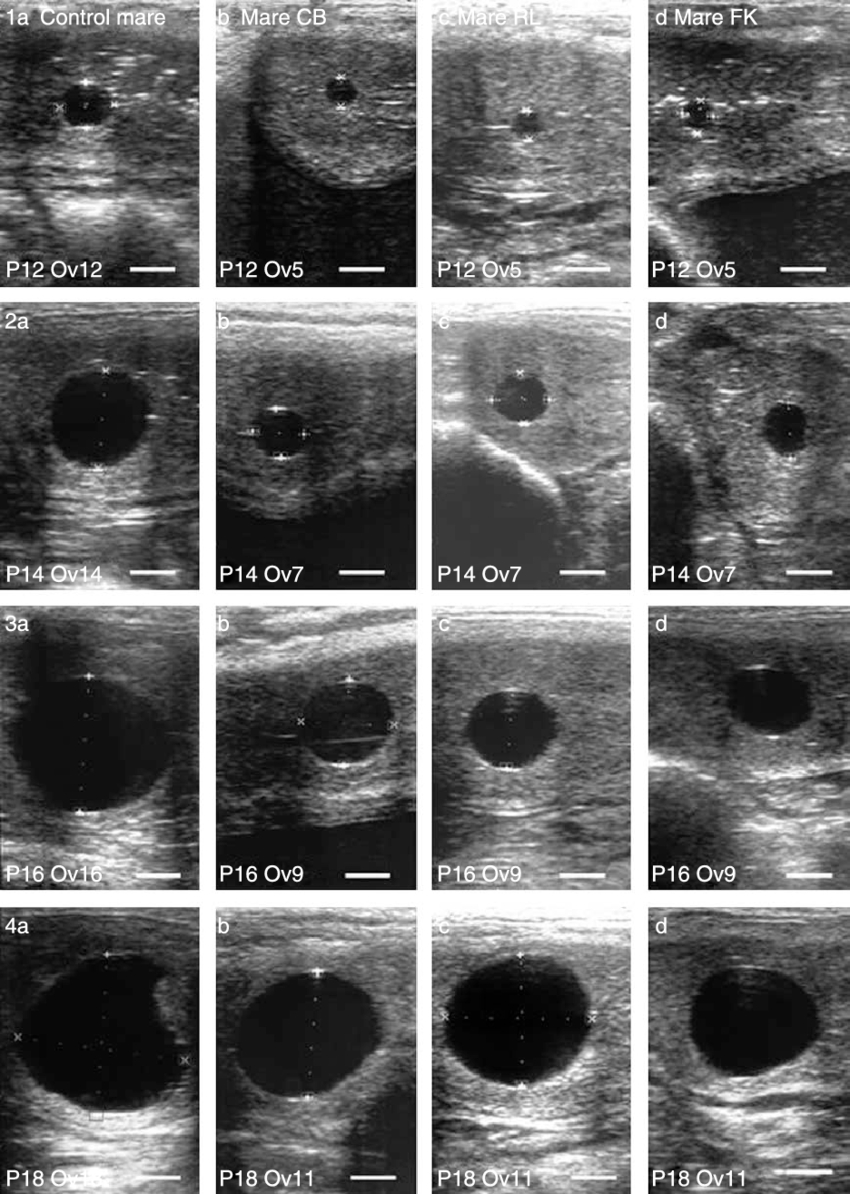 Embryonic Development Between Days 12 And 18 Of Gestation In A for Day By Day Pregnancy Pictures