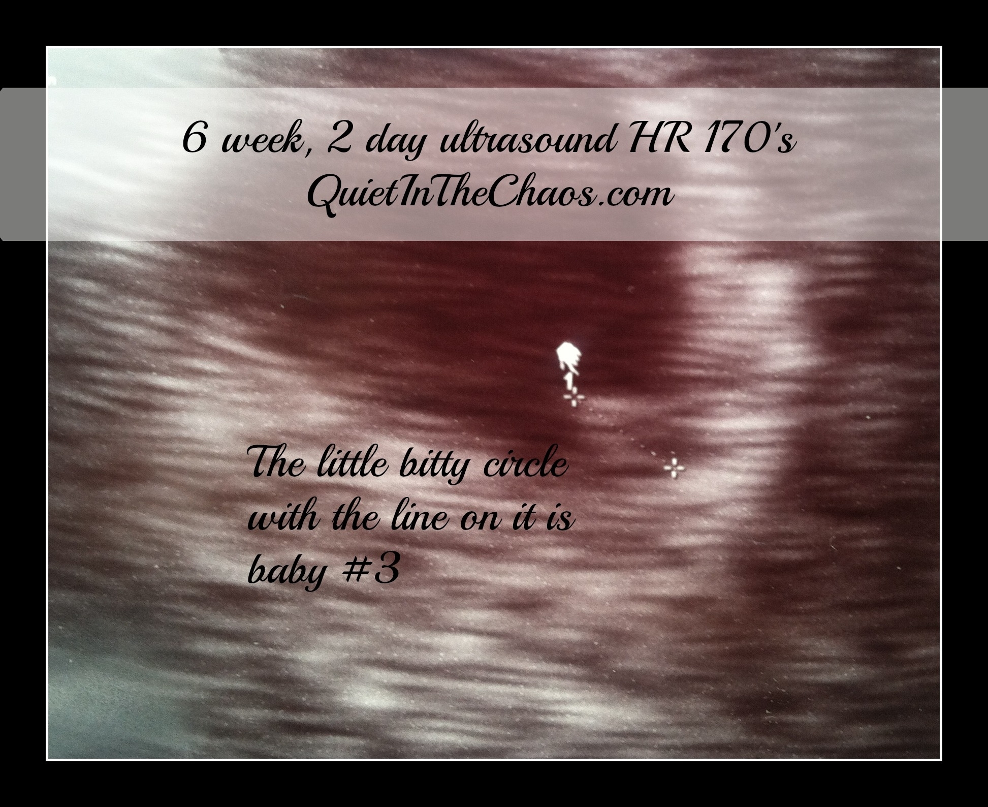 Pregnancy #3 Update: Beginning Of Second Trimester - Quiet In The Chaos with regard to Weeks Of Pregnancy Day By Day