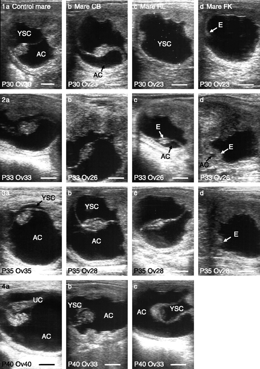 Uterine Influences On Embryogenesis And Early Placentation In The intended for Day By Day Pregnancy Pictures