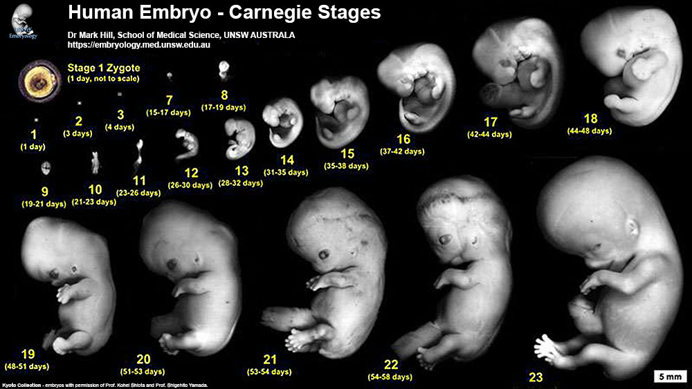 Fetal Echo Meeting 2012 - Embryology